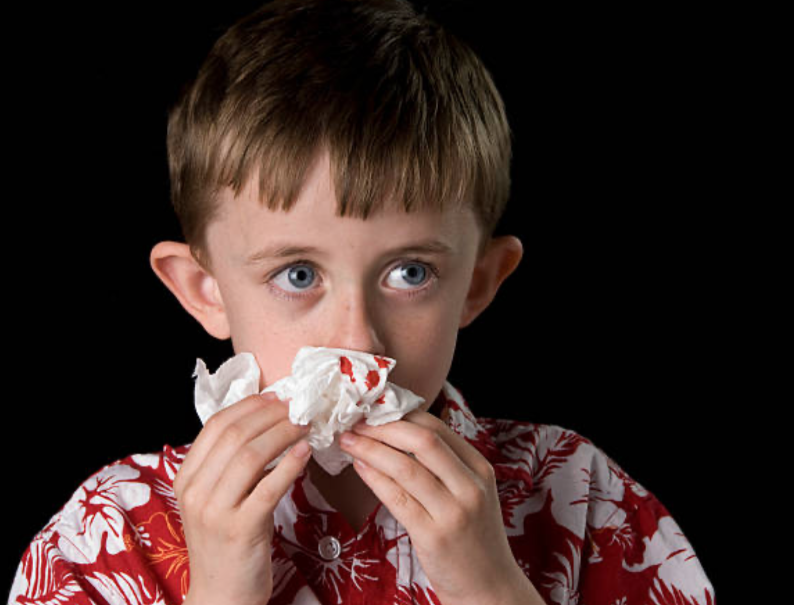 小孩常常流鼻血 九成伴有鼻過敏